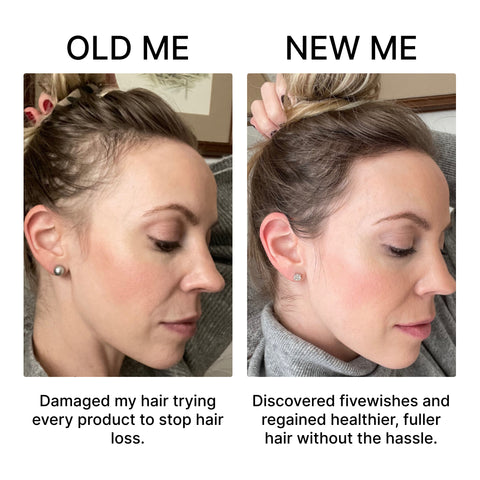 30-Day Supply + 30-Day Hair Growth Guide