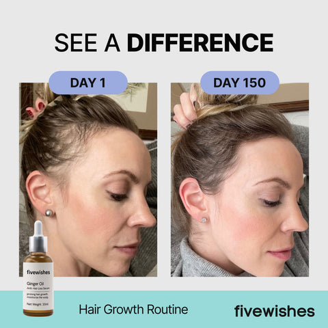 30-Day Supply + 30-Day Hair Growth Guide