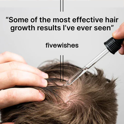 60-Day Supply + 60-Day Hair Growth Guide